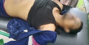 Lawan Petugas Dengan Pisau, Pelaku Begal di Tembak