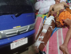 Remaja Korban Kecelakaan di Curup Timur Masih Terbaring, Polisi Tunggu Hasil Mediasi
